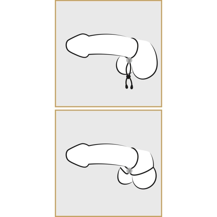 BK cock & ball loop